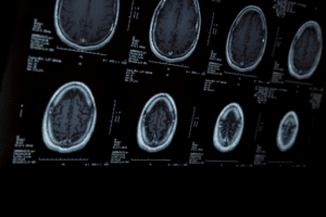 Eight images depicting a brain scan